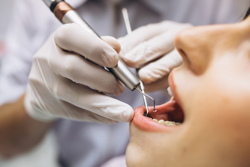 Facetas de porcelana: o caminho para um sorriso de celebridade com a reabilitação oral 3 dentista